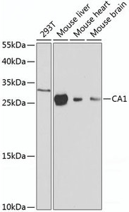 Western blot analysis of extracts of various cell lines using CA1 Polyclonal Antibody at dilution of 1:1000.