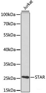 Western blot analysis of extracts of various cell lines using STAR Polyclonal Antibody at dilution of 1:1000.