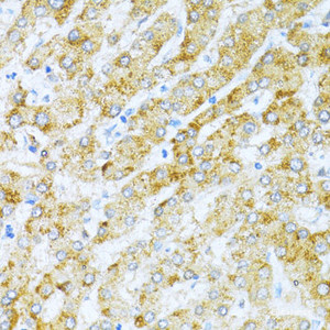 Immunohistochemistry of paraffin-embedded Human liver using KLHL42 Polyclonal Antibody at dilution of 1:100 (40x lens) .