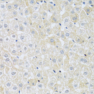 Immunohistochemistry of paraffin-embedded Rat liver using SLC4A5 Polyclonal Antibody at dilution of 1:100 (40x lens) .