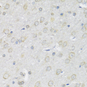 Immunohistochemistry of paraffin-embedded Rat brain using P2RX7 Polyclonal Antibody at dilution of 1:100 (40x lens) .