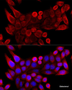 Immunofluorescence analysis of HeLa cells using VDAC3 Polyclonal Antibody at dilution of 1:100 (40x lens) . Blue: DAPI for nuclear staining.