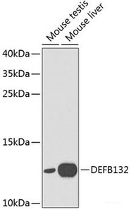 Western blot analysis of extracts of various cell lines using DEFB132 Polyclonal Antibody at dilution of 1:1000.