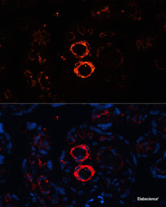 Immunofluorescence analysis of Human placenta cells using MYH11 Polyclonal Antibody at dilution of 1:100. Blue: DAPI for nuclear staining.