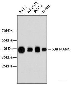 Western blot analysis of extracts of various cell lines using p38 MAPK Polyclonal Antibody.