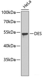 Western blot analysis of extracts of HeLa cells using DES Polyclonal Antibody.