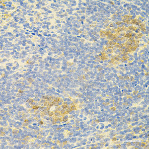 Immunohistochemistry of paraffin-embedded Mouse spleen using APP Polyclonal Antibody at dilution of 1:100 (40x lens) .