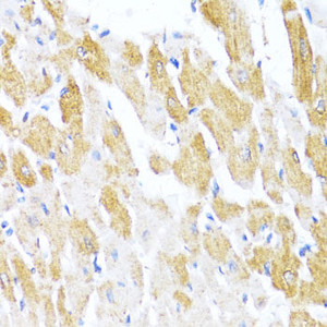 Immunohistochemistry of paraffin-embedded Rat heart using CTGF Polyclonal Antibody at dilution of 1:100 (40x lens) .