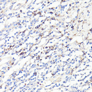 Immunohistochemistry of paraffin-embedded Human tonsil using IL6 Polyclonal Antibody at dilution of 1:100 (40x lens) .