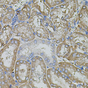Immunohistochemistry of paraffin-embedded Mouse kidney using MMP9 Polyclonal Antibody at dilution of 1:100 (40x lens) .