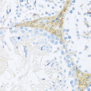 Immunohistochemistry of paraffin-embedded Mouse leydig cells using NRF2 Polyclonal Antibody at dilution of 1:100 (40x lens) .