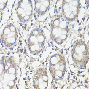 Immunohistochemistry of paraffin-embedded Human colon using FAK Polyclonal Antibody at dilution of 1:100 (40x lens) .