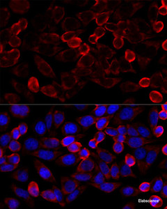 Immunofluorescence analysis of HeLa cells using HDAC6 Polyclonal Antibody at dilution of 1:100 (40x lens) . Blue: DAPI for nuclear staining.