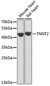 Western blot analysis of extracts of various cell lines using TNNT2 Polyclonal Antibody at dilution of 1:1000.