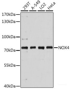 Western blot analysis of extracts of various cell lines using NOX4 Polyclonal Antibody at dilution of 1:3000.
