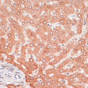 Immunohistochemistry of paraffin-embedded Human liver using ATG5 Polyclonal Antibody at dilution of 1:100 (40x lens) .