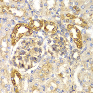 Immunohistochemistry of paraffin-embedded Rat kidney using ASC / TMS1 Polyclonal Antibody at dilution of 1:100 (40x lens) .