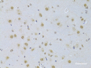 Immunohistochemistry of paraffin-embedded Rat brain using CDKN1A Polyclonal Antibody at dilution of 1:100 (40x lens) .