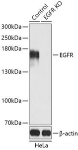 Western blot analysis of extracts of HeLa cells using EGFR Polyclonal Antibody at dilution of 1:3000.