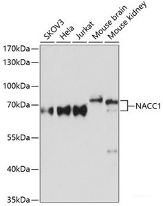 Western blot analysis of extracts of various cell lines using NACC1 Polyclonal Antibody at dilution of 1:3000.