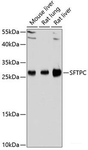 Western blot analysis of extracts of various cell lines using SFTPC Polyclonal Antibody at dilution of 1:1000.