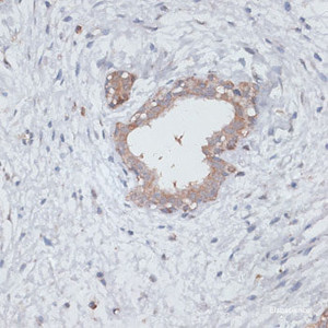 Immunohistochemistry of paraffin-embedded Human breast using TGFBR2 Polyclonal Antibody at dilution of 1:100 (40x lens) .