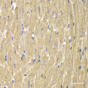 Immunohistochemistry of paraffin-embedded Mouse heart using NOXA2 / P67phox Polyclonal Antibody at dilution of 1:100 (40x lens) .