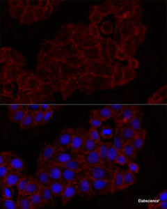 Immunofluorescence analysis of HeLa cells using KLRK1 Polyclonal Antibody at dilution of 1:100. Blue: DAPI for nuclear staining.