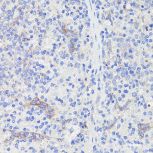Immunohistochemistry of paraffin-embedded Mouse spleen using PD-1 Polyclonal Antibody at dilution of 1:200 (40x lens) .