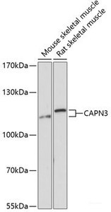 Western blot analysis of extracts of various cell lines using CAPN3 Polyclonal Antibody at dilution of 1:3000.