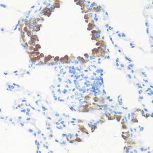 Immunohistochemistry of paraffin-embedded Mouse lung using FGF10 Polyclonal Antibody at dilution of 1:100 (40x lens) .