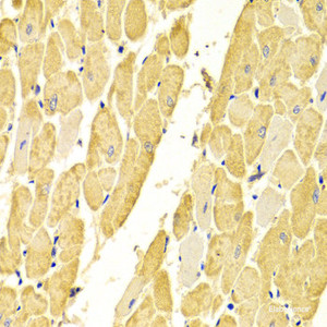 Immunohistochemistry of paraffin-embedded Rat heart using CA3 Polyclonal Antibody at dilution of 1:100 (40x lens) .