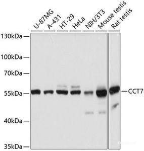 Western blot analysis of extracts of various cell lines using CCT7 Polyclonal Antibody at dilution of 1:3000.