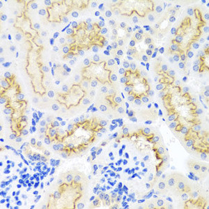 Immunohistochemistry of paraffin-embedded Mouse kidney using SRPX Polyclonal Antibody at dilution of 1:100 (40x lens) .