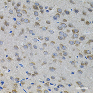 Immunohistochemistry of paraffin-embedded Rat brain using Snail Polyclonal Antibody