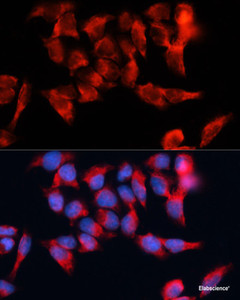 Immunofluorescence analysis of HeLa cells using BST2 Polyclonal Antibody at dilution of 1:100. Blue: DAPI for nuclear staining.