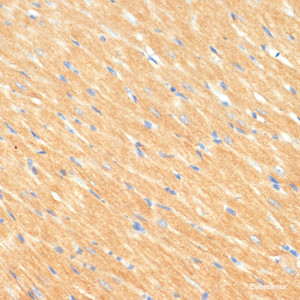 Immunohistochemistry of paraffin-embedded Rat heart using MYBPC3 Polyclonal Antibody at dilution of 1:100 (40x lens) .