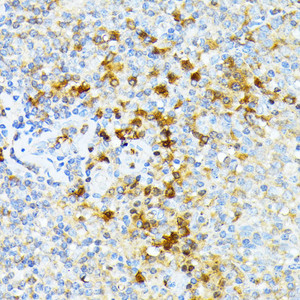 Immunohistochemistry of paraffin-embedded Human tonsil using SPTA1 Polyclonal Antibody at dilution of 1:100 (40x lens) .