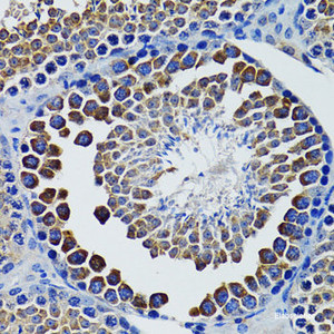 Immunohistochemistry of paraffin-embedded Rat testis using HEXA Polyclonal Antibody at dilution of 1:100 (40x lens) .