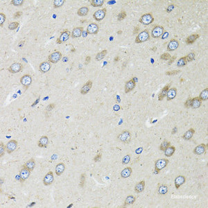 Immunohistochemistry of paraffin-embedded Rat brain using OGDH Polyclonal Antibody at dilution of 1:100 (40x lens) .