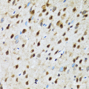 Immunohistochemistry of paraffin-embedded Rat brain using PSMD13 Polyclonal Antibody at dilution of 1:100 (40x lens) .