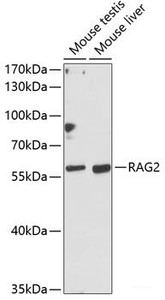 Western blot analysis of extracts of various cell lines using RAG2 Polyclonal Antibody at dilution of 1:1000.