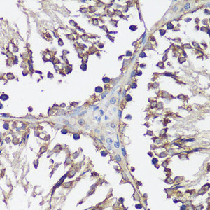 Immunohistochemistry of paraffin-embedded Rat testis using VAMP2 Polyclonal Antibody at dilution of 1:100 (40x lens) .