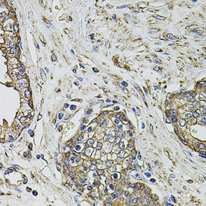 Immunohistochemistry of paraffin-embedded Human prostate using PTHLH Polyclonal Antibody at dilution of 1:100 (40x lens) .