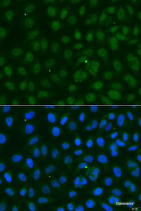 Immunofluorescence analysis of U2OS cells using SUMO1 Polyclonal Antibody at dilution of 1:100. Blue: DAPI for nuclear staining.