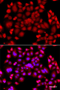 Immunofluorescence analysis of A549 cells using PIP4K2B Polyclonal Antibody
