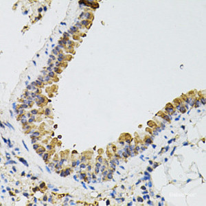 Immunohistochemistry of paraffin-embedded Mouse lung using ARHGEF2 Polyclonal Antibody at dilution of 1:100 (40x lens) .