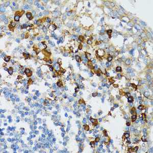 Immunohistochemistry of paraffin-embedded Human tonsil using Bim Polyclonal Antibody at dilution of 1:100 (40x lens) .