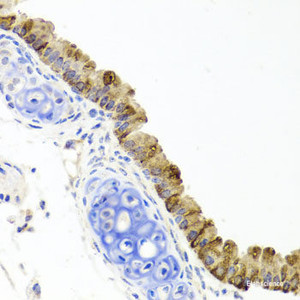 Immunohistochemistry of paraffin-embedded Mouse lung using TOPBP1 Polyclonal Antibody at dilution of 1:100 (40x lens) .