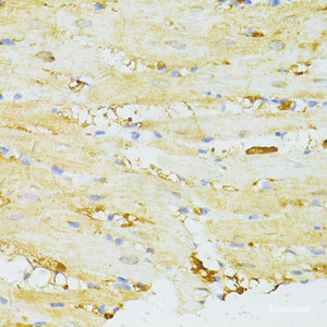 Immunohistochemistry of paraffin-embedded Rat heart using SIRT2 Polyclonal Antibody at dilution of 1:100 (40x lens) .